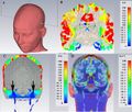 Finite Elements - electric field within the intracranial brain tissue - FEM.jpg