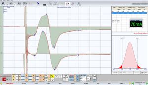Transcranial Stimulation 1.jpeg