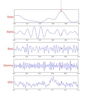 EEG.jpeg