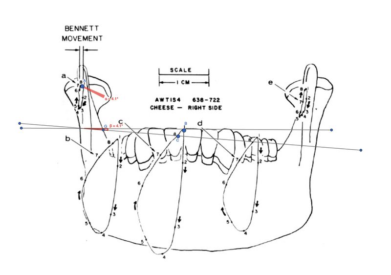 File:Sirognathograph frontal angle.jpg