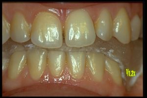 ETCS post ortognatica.jpeg