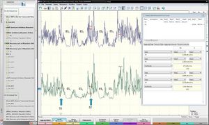 CR MIR masseter inhibitory recovery cycle reflex.jpg