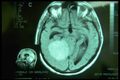 Thumbnail for version as of 12:22, 23 April 2023
